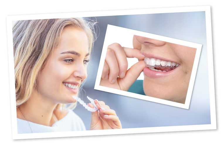 Learn about Invisalign braces